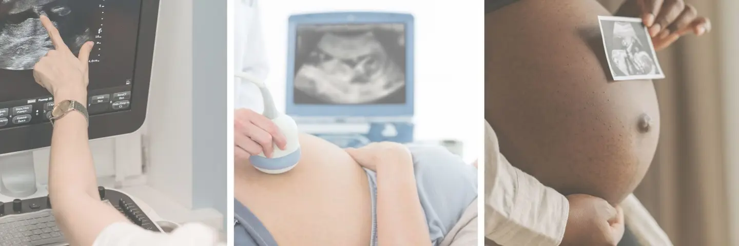 Here’s Exactly What To Eat Before Ultrasound: Pregnancy Edition